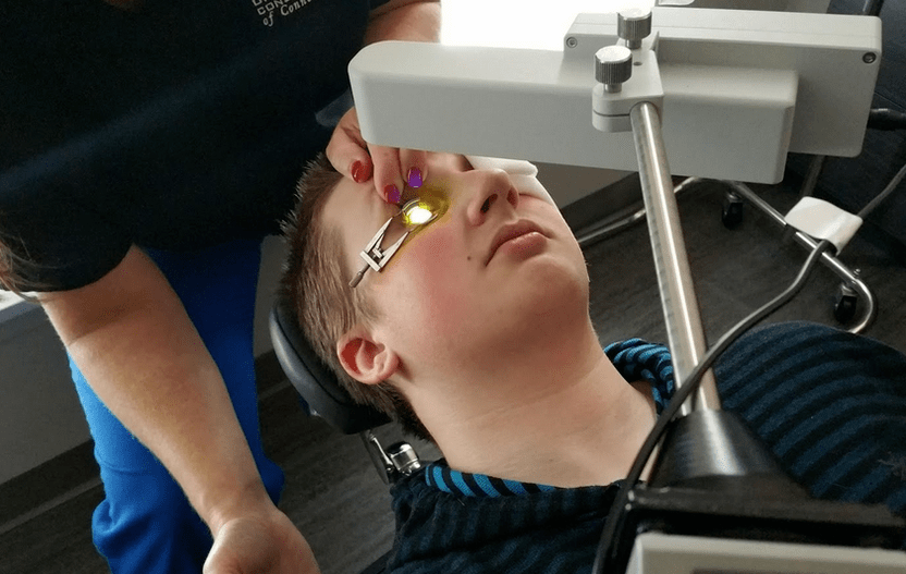 Η δικτύωση εξαλείφει αποτελεσματικά το keratoconus στην αρχή της ανάπτυξής του
